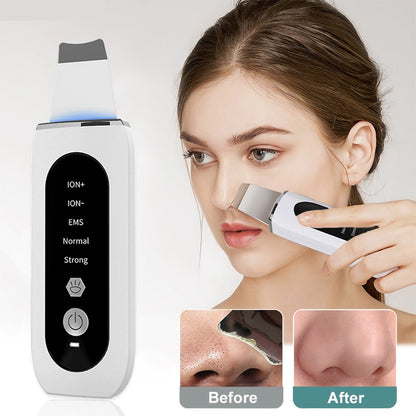 Skin Scrubber Peeling Blackhead Remover